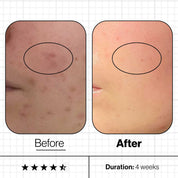 Skin Clear Biome