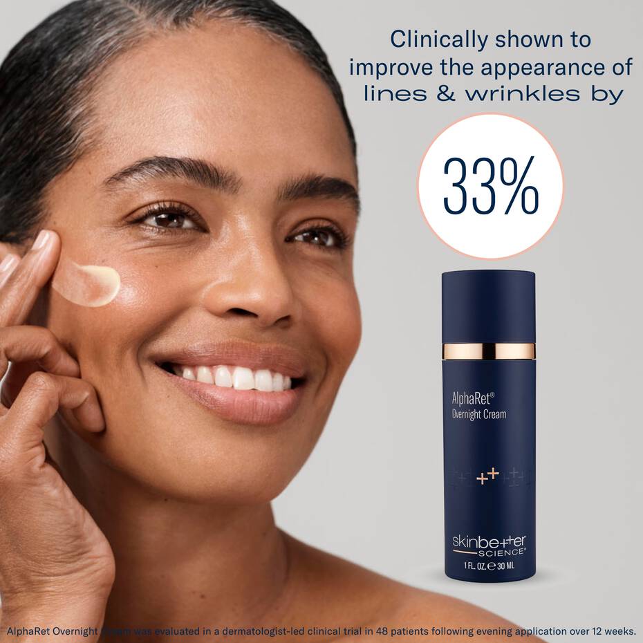 AlphaRet Overnight Cream benefits for fine lines and wrinkles