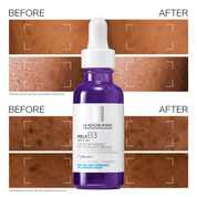 Mela B3 Dark Spot Serum