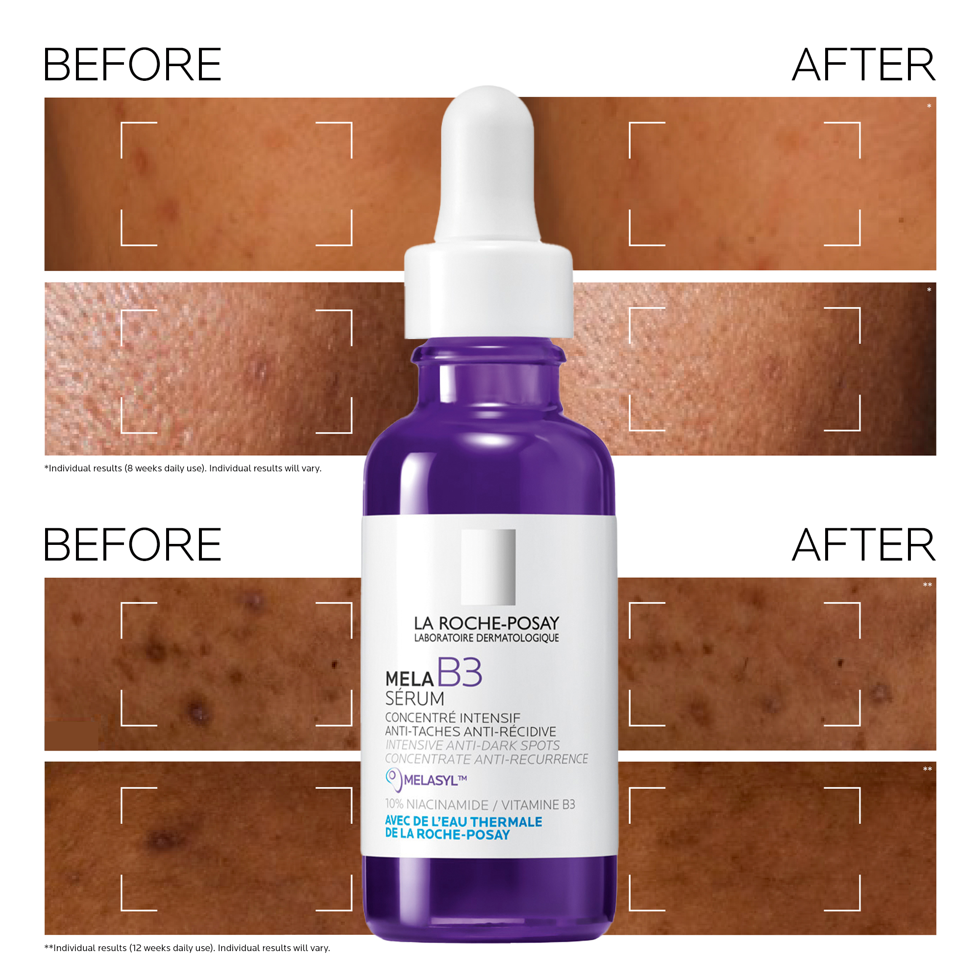 Mela B3 Dark Spot Serum