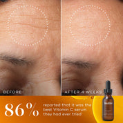 C-Tetra® Luxe Serum
