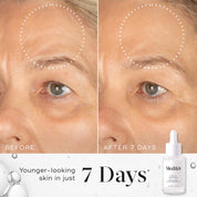 Medik8 Liquid Peptides Results