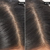 Inkey_List_Salicylic_Acid_Scalp_Treatment_Before_After