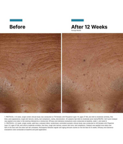 Skinceuticals H.A Intensifier Multi-Glycan Before and After