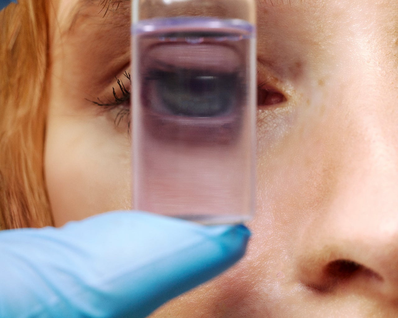 THE SKIN BARRIER, THE MICROBIOME AND WHY IT MATTERS