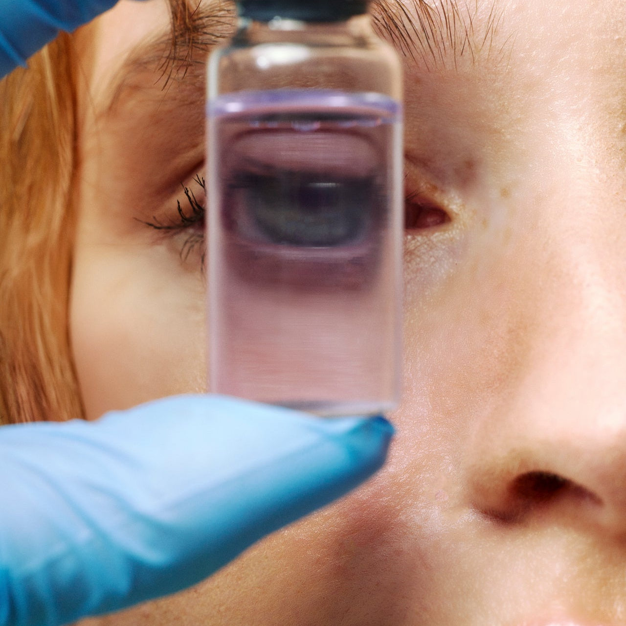 THE SKIN BARRIER, THE MICROBIOME AND WHY IT MATTERS