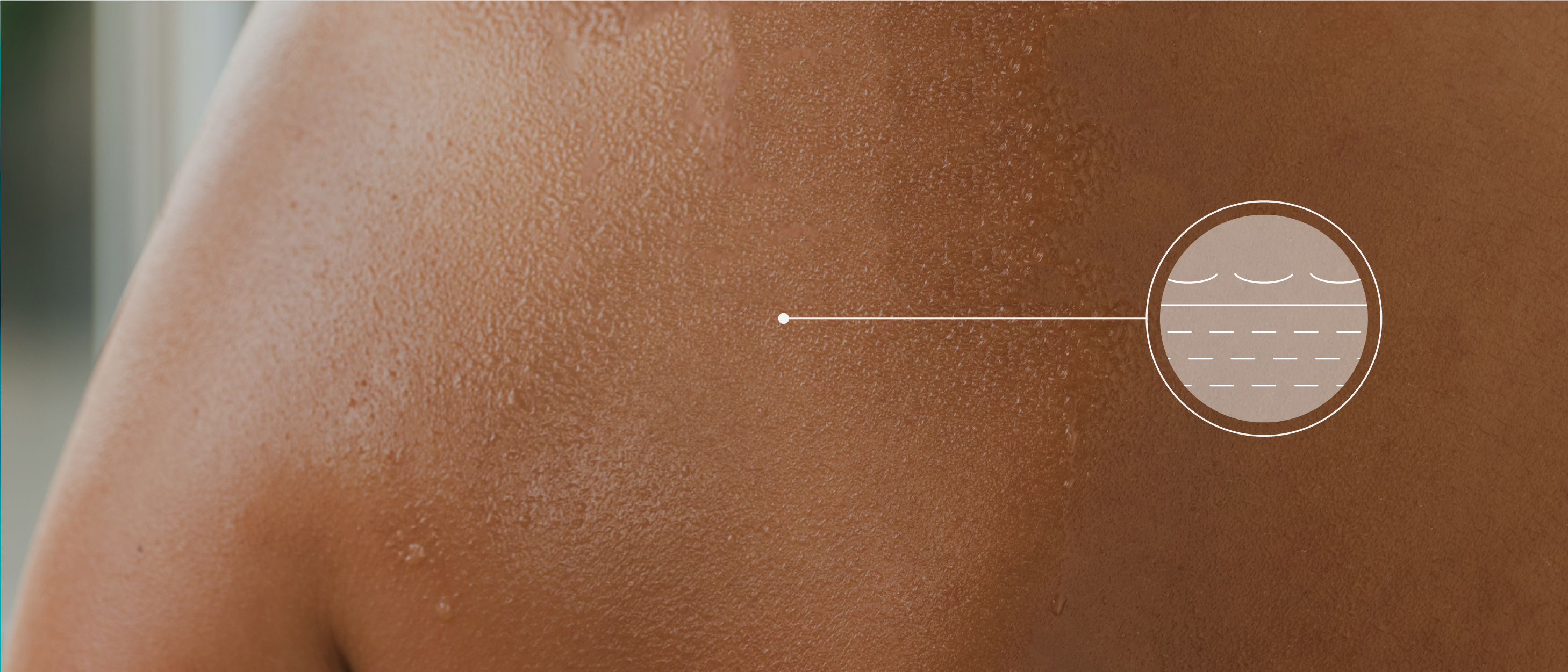 Close-up image of a persons back with visible droplets of water on the skin. A circular inset shows a diagram of skin layers with a focus on hydration.