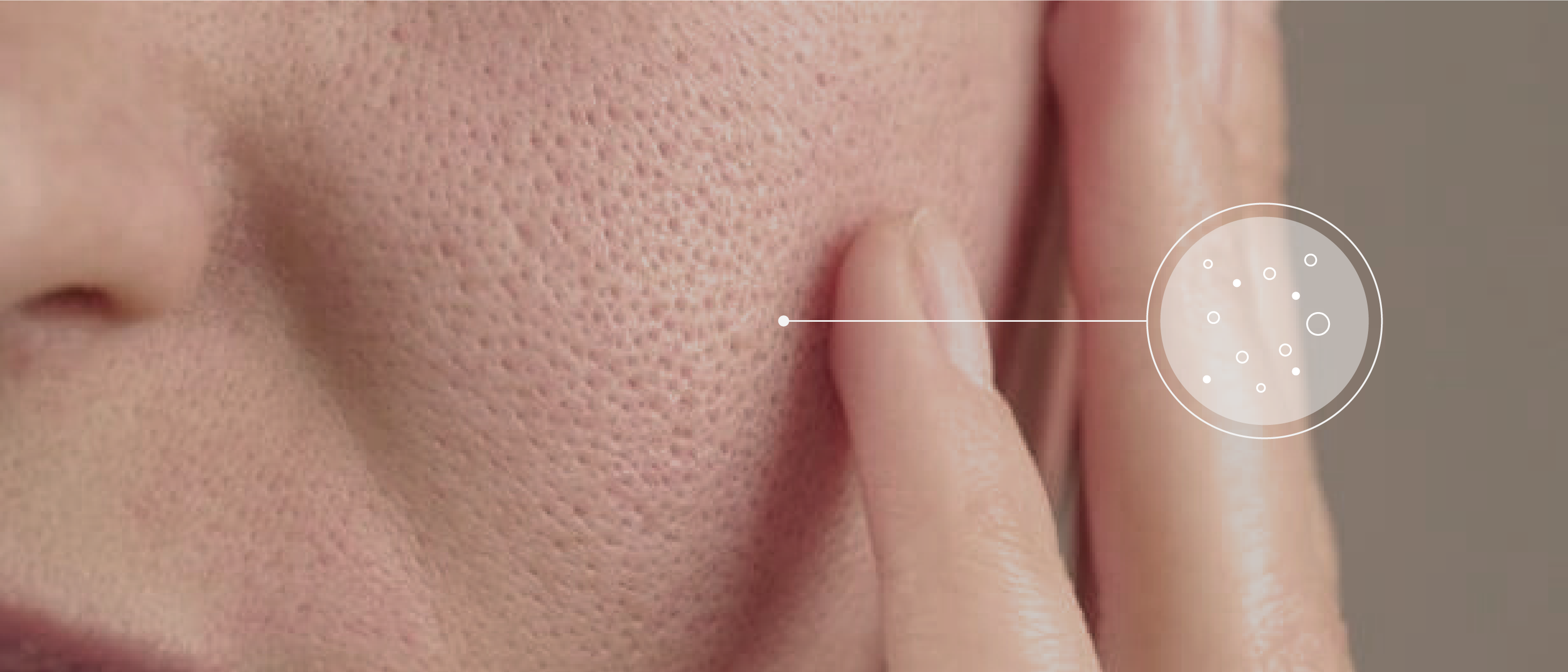 Close-up of a person touching their cheek, which has visible pores. A graphic circle with dots highlights the texture of the skin, emphasising pore appearance.