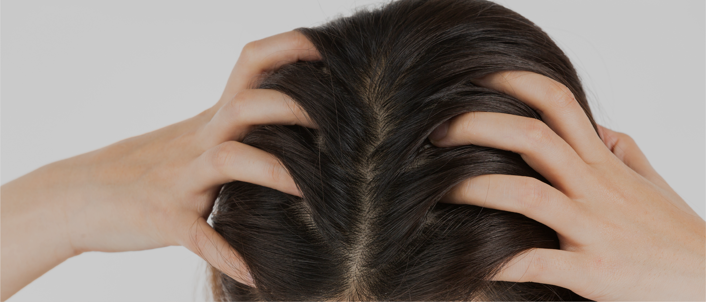 A close-up of hands running through dark hair on the top of a head showing areas of the scalp.