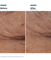 Radiance Regime