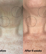 Bio-Active Ceramide Neck Stick