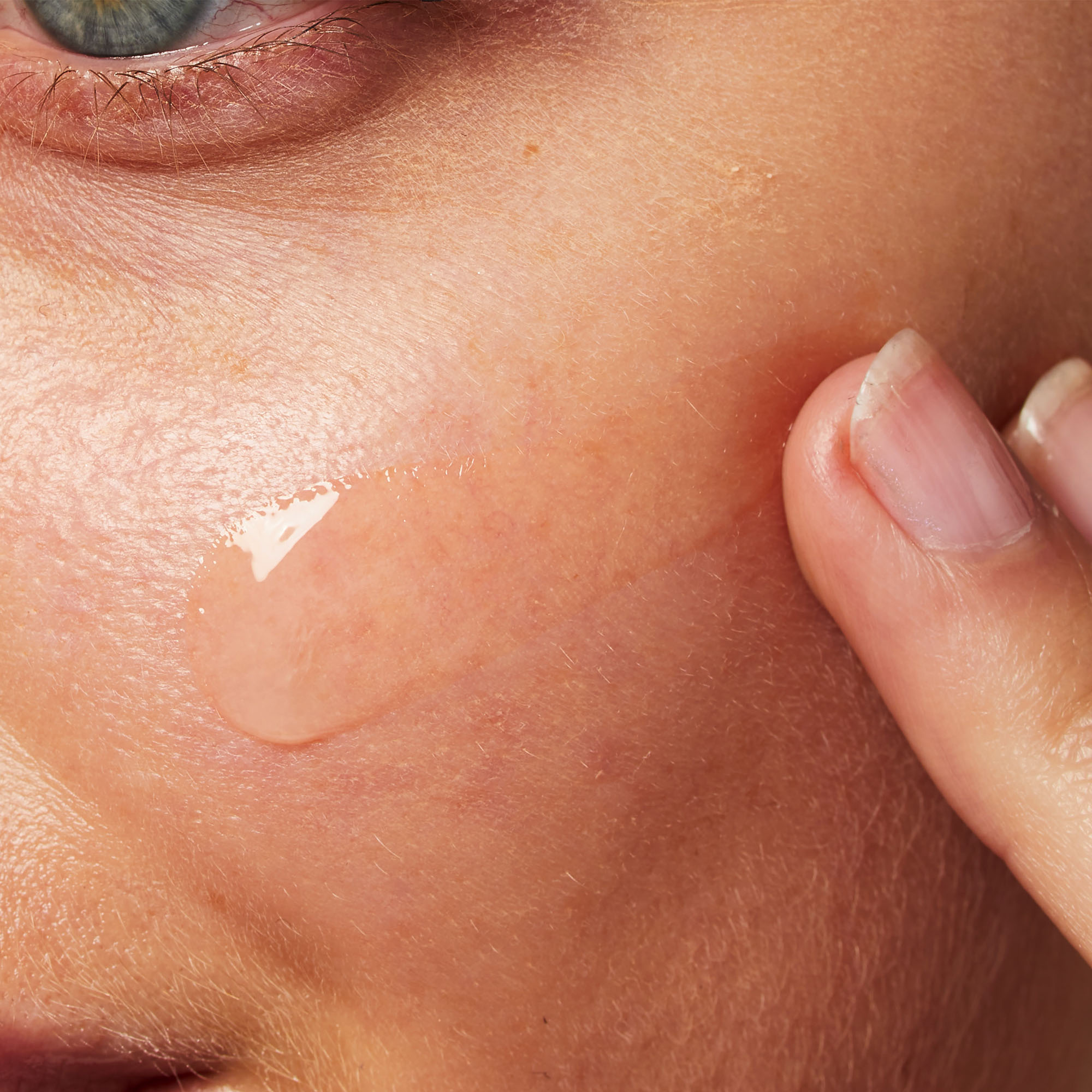 Blemish Control Gel