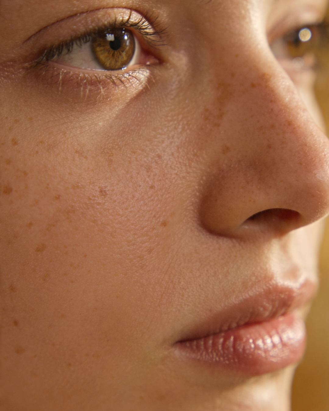 DARK_SPOTS_MELASMA_SUN_DAMAGE_WHAT_S_THE_DIFFERENCE.png