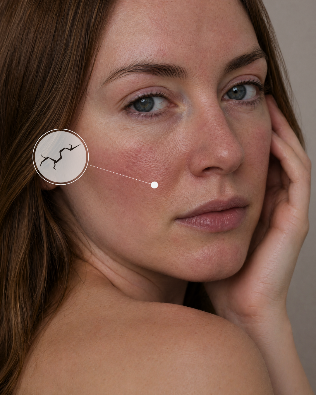 Damaged_Skin_Barrier_Cover.png