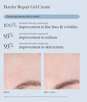 Dr. Loretta Barrier Repair Hydrating Gel Cream 50ml before and after model face image