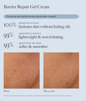 Dr. Loretta Barrier Repair Hydrating Gel Cream 50ml before and after shot of models face