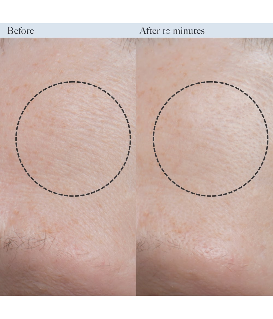 Dr. Loretta Resurfacing Enzyme Polish 50ml before and after skin close up image