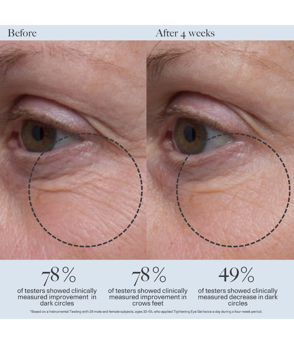 Dr. Loretta Tightening Eye Gel 20ml model image before and after close up shot 
