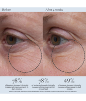 Dr. Loretta Tightening Eye Gel 20ml model image before and after close up shot 
