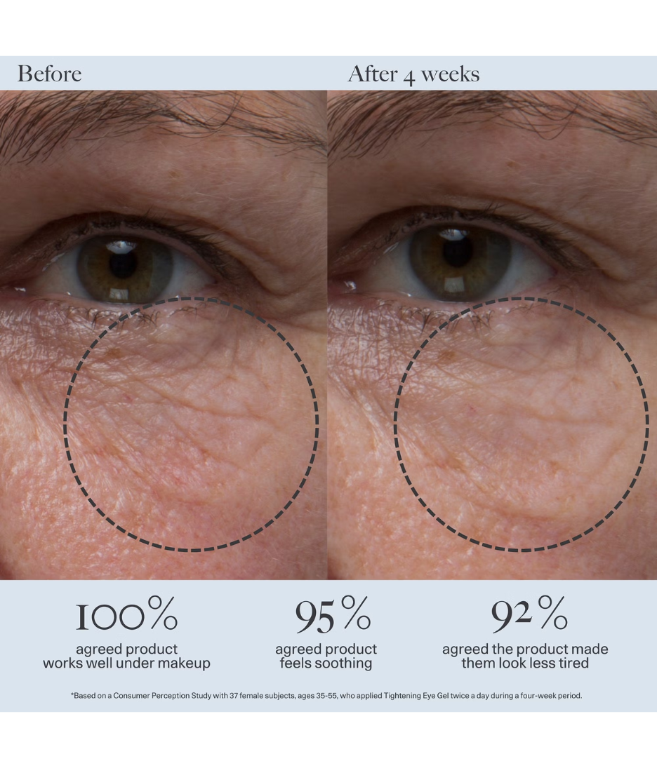 Dr. Loretta Tightening Eye Gel 20ml model image before and after close up shot 
