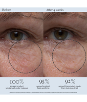 Dr. Loretta Tightening Eye Gel 20ml model image before and after close up shot 
