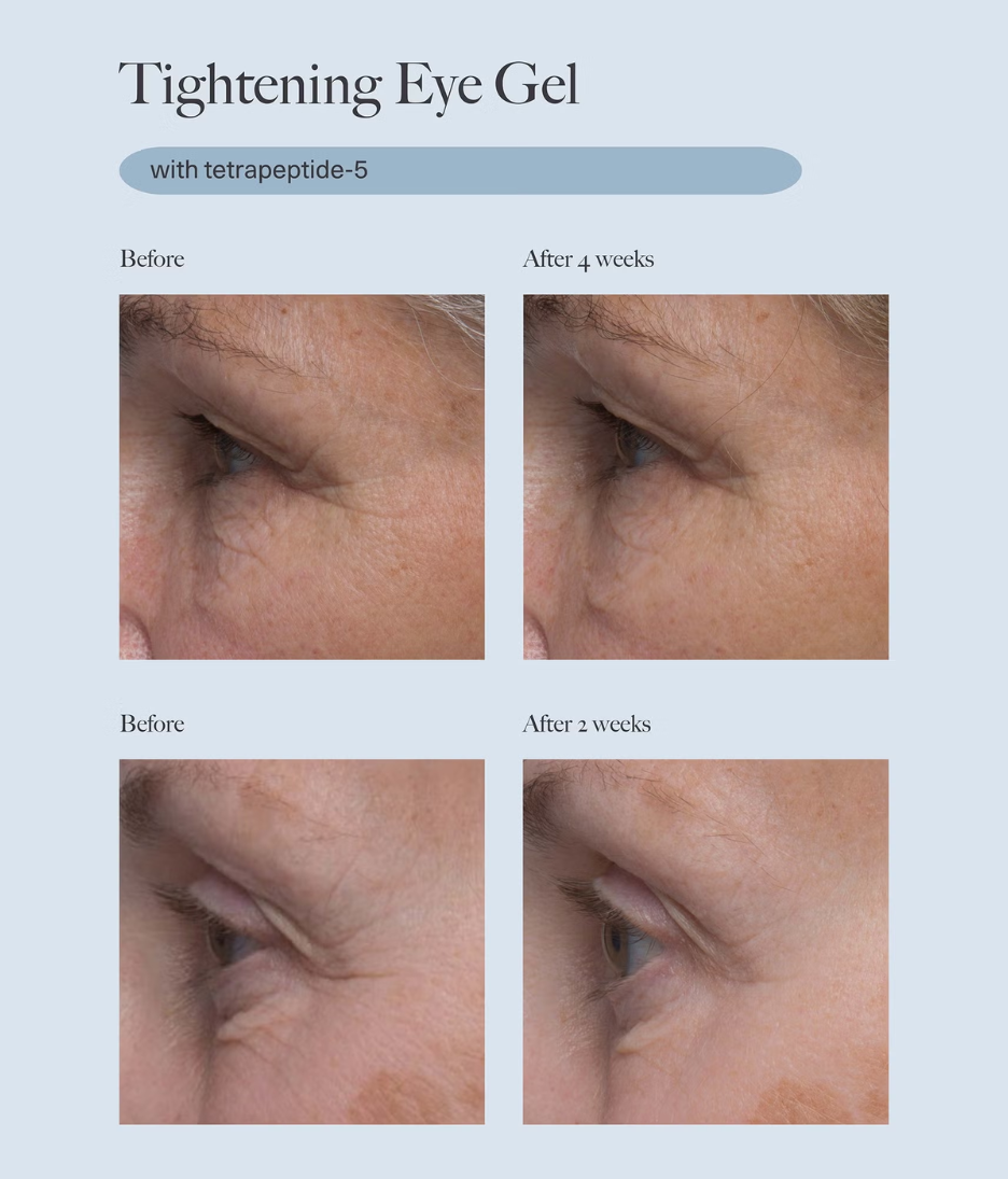 Dr. Loretta Tightening Eye Gel 20ml model image before and after close up shot 
