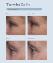 Dr. Loretta Tightening Eye Gel 20ml model image before and after close up shot 
