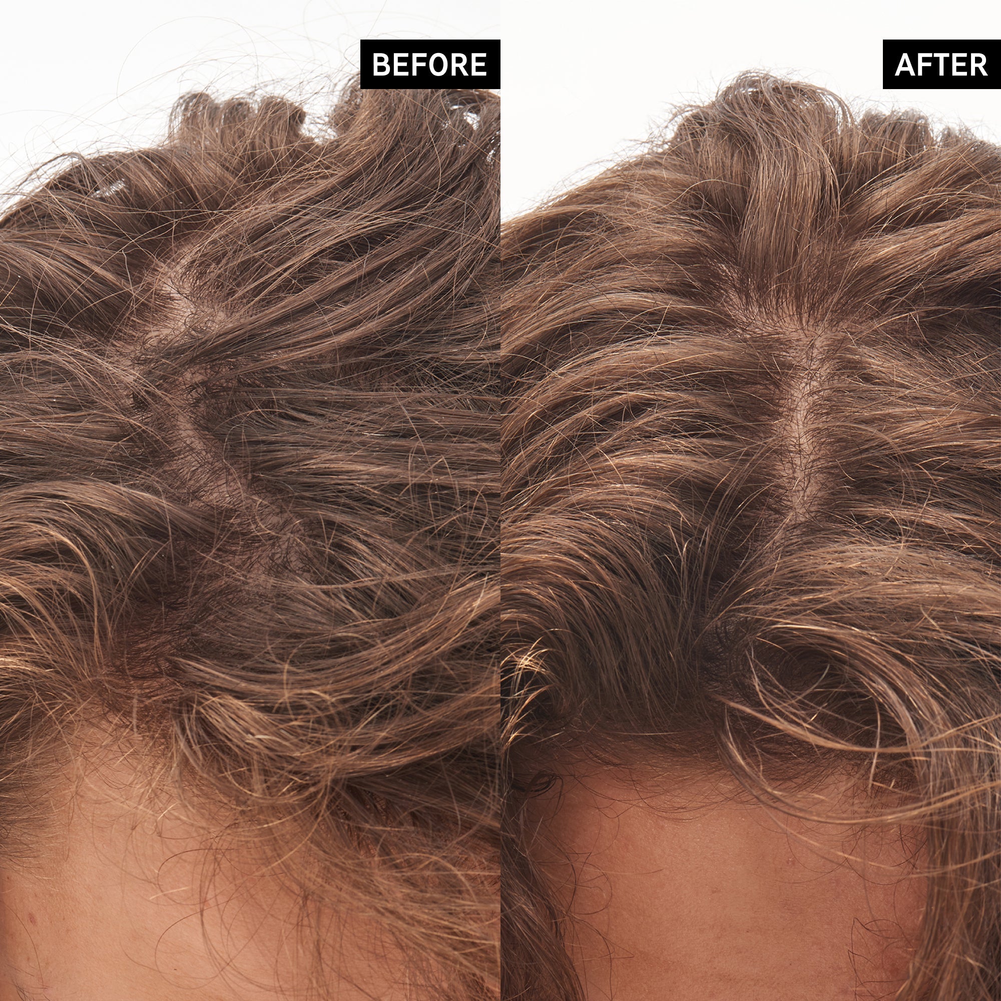 Inkey_List_Glycolic_Acid_Exfoliating_Scalp_Scrub_Before_After