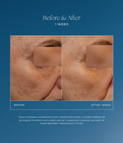 IS Clinical Daily Dynamic Hydrator before and after 