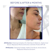 Hydra Cool Serum
