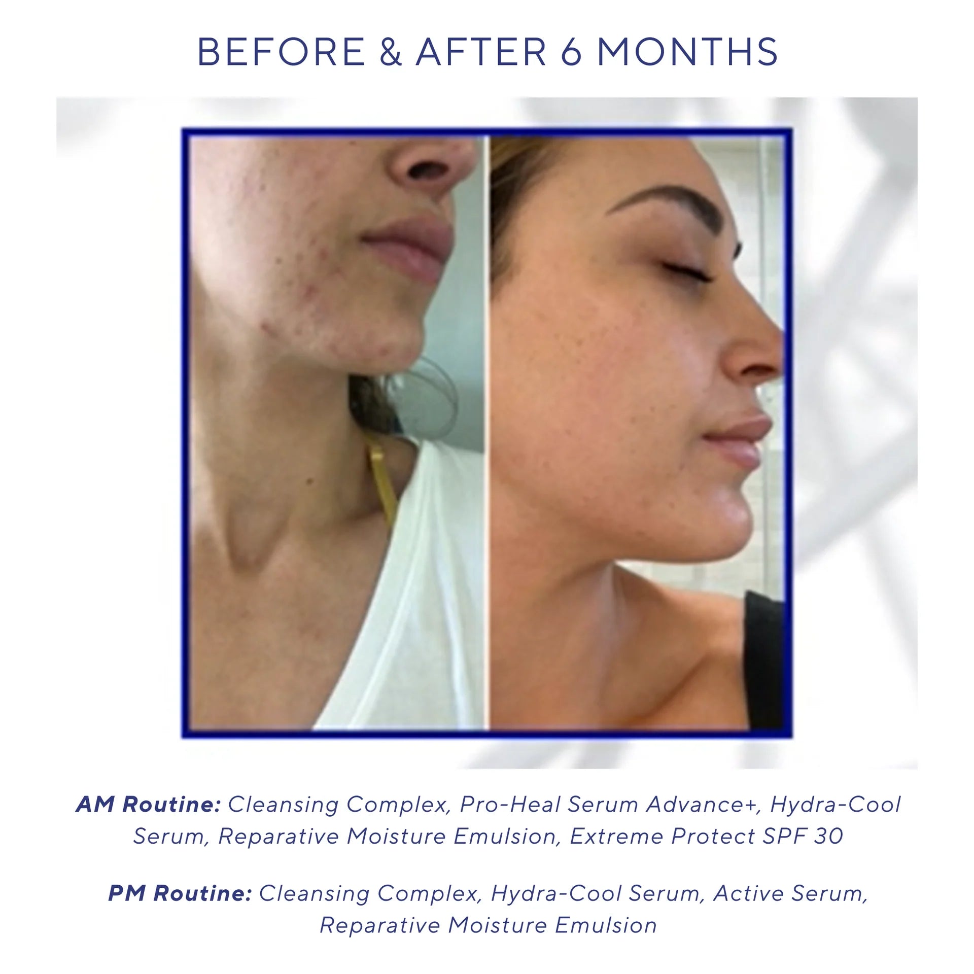 Hydra Cool Serum