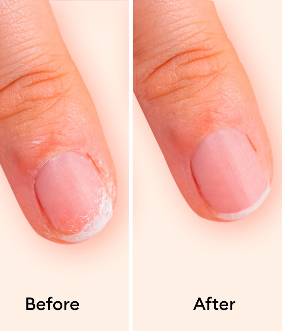 ManicuristKeratineBoosterbeforeandafter.png