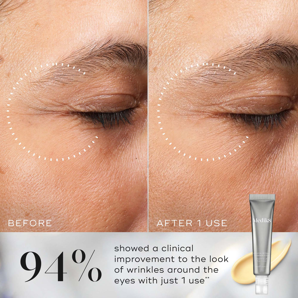 Medik8 Crystal Retinal Ceramide Eye Results