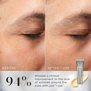 Medik8 Crystal Retinal Ceramide Eye Results