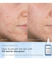 Niacinamide Peptides