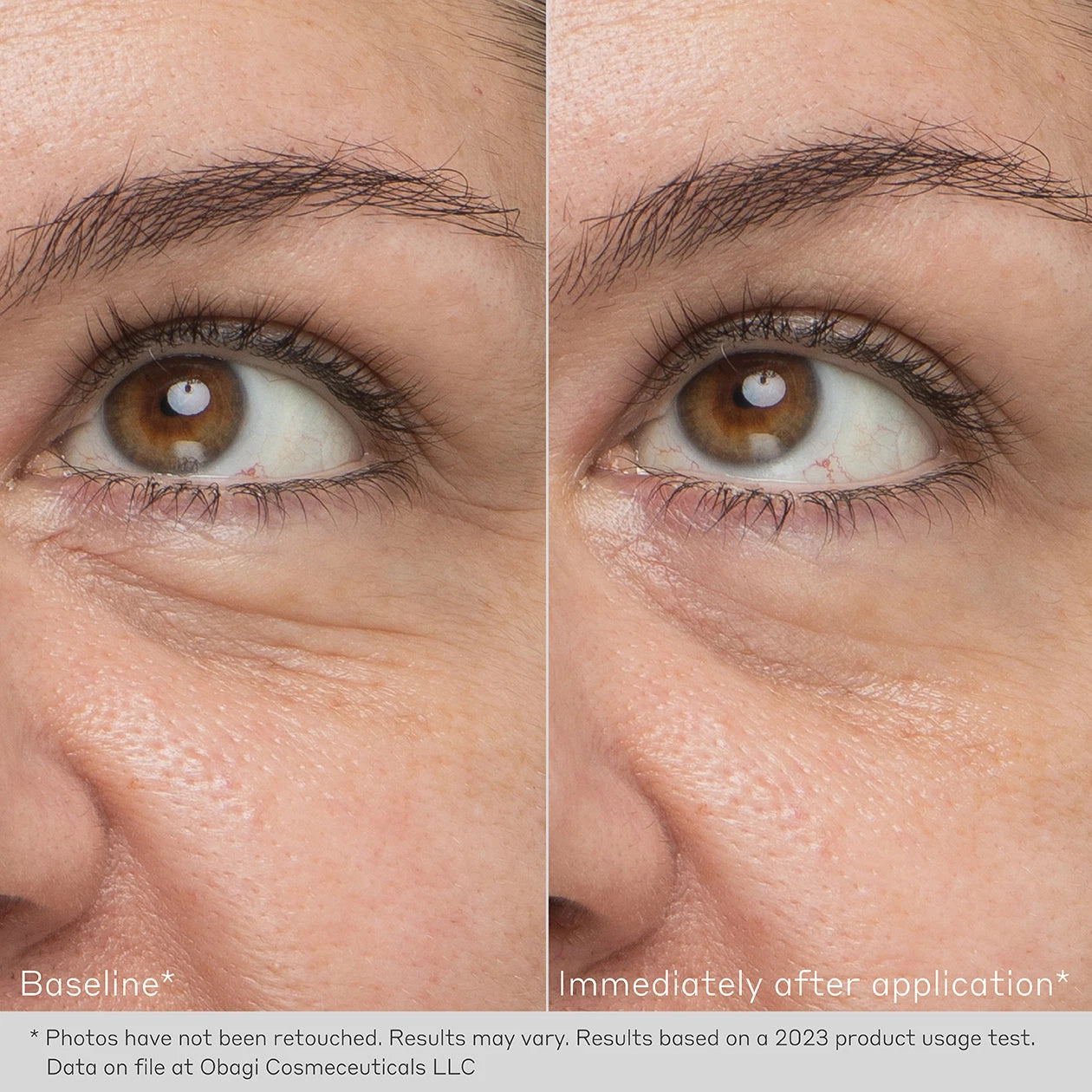 Obagi Hydro Drops Rejuvenating Eye Gel Cream Before After