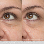 Obagi Hydro Drops Rejuvenating Eye Gel Cream Before After