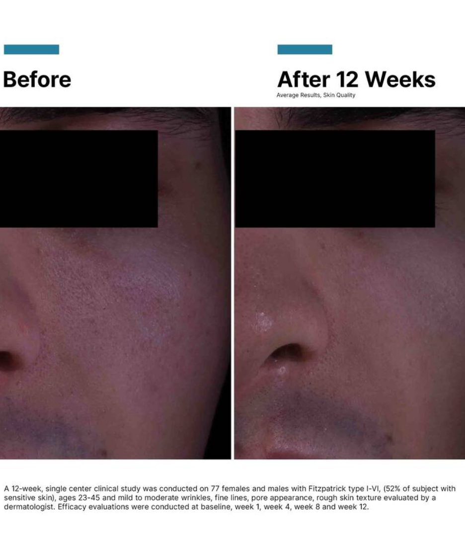 SkinCeuticals P-TIOX Cream micro-melting gel-cream texture closeup before and after model