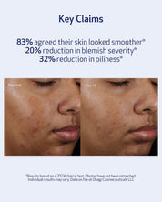 Pore Therapy