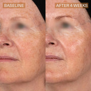 Pro Helix C Serum