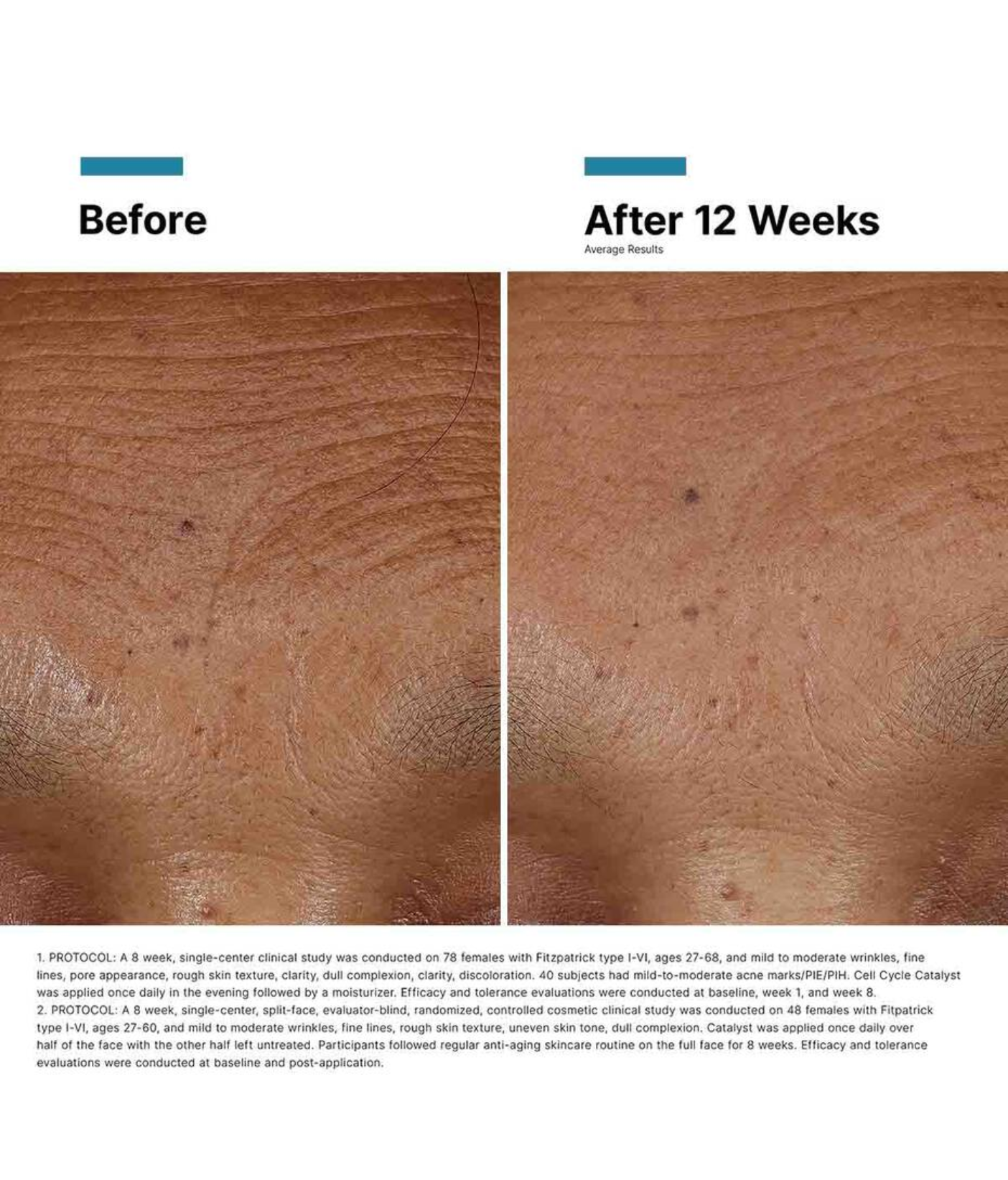 Skinceuticals H.A Intensifier Multi-Glycan Before and After